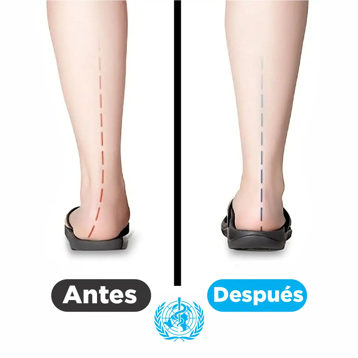 Setepps 2x1: Camina sin dolor. Transforma tus zapatos en terapia de alivio, sin esfuerzo