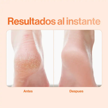 Dermo Feet Pro: Recupera la suavidad y la seguridad de mostrar tus pies... en solo 5 minutos al día