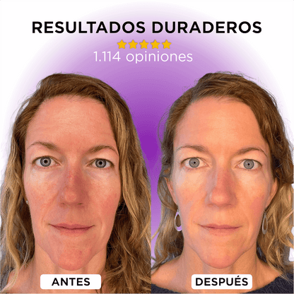 Dermawand Pro: Rejuvenece tu piel en 10 minutos, sin tratamientos invasivos y sin dolor + Retinol antienvejecimiento GRATIS