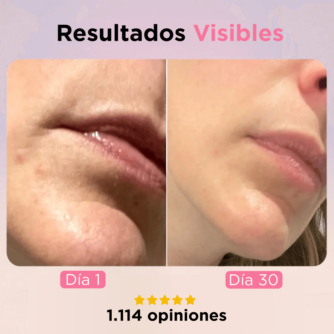 SolaWave Pro: Tratamiento contra las ojeras y la hinchazón en 10 minutos. Con retinol antiojeras y antiedad.