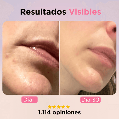 SolaWave Pro: Tratamiento contra las ojeras y la hinchazón en 10 minutos. Con retinol antiojeras y antiedad.