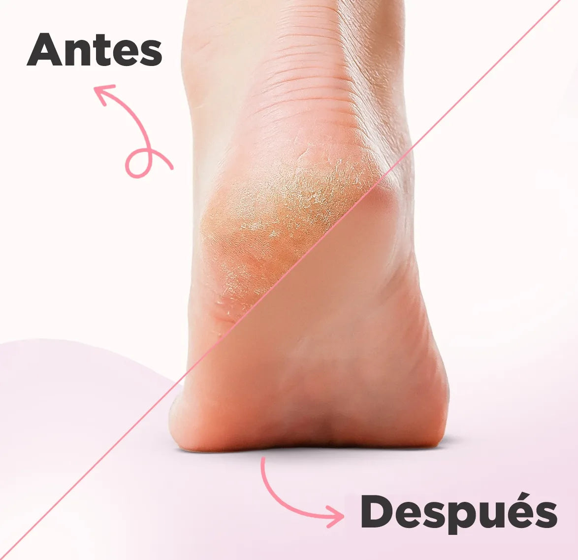 FootGlow: Adiós callos y talones agrietados, ¡hola pies suaves y saludables!