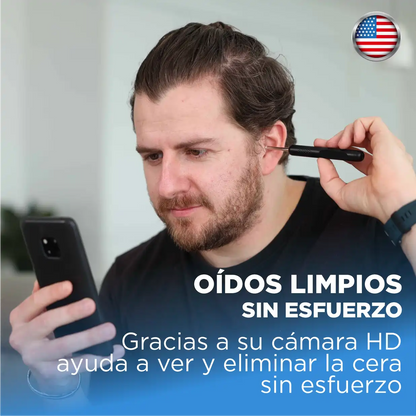 Smart Ear:  Limpia tus oídos de manera precisa, segura y profesional desde casa