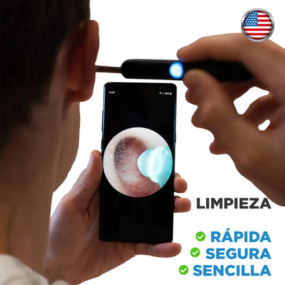 Smart Ear:  Limpia tus oídos de manera precisa, segura y profesional desde casa