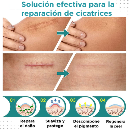 Renacil: Reduce la apariencia de las líneas en tu piel mientras duermes