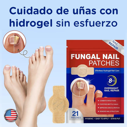 FungalNail Patches: Combate los hongos y repara tus uñas mientras duermes