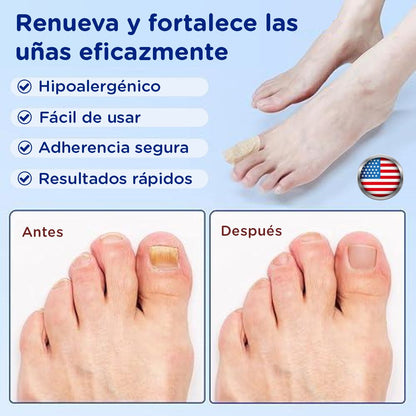 FungalNail Patches: Combate los hongos y repara tus uñas mientras duermes