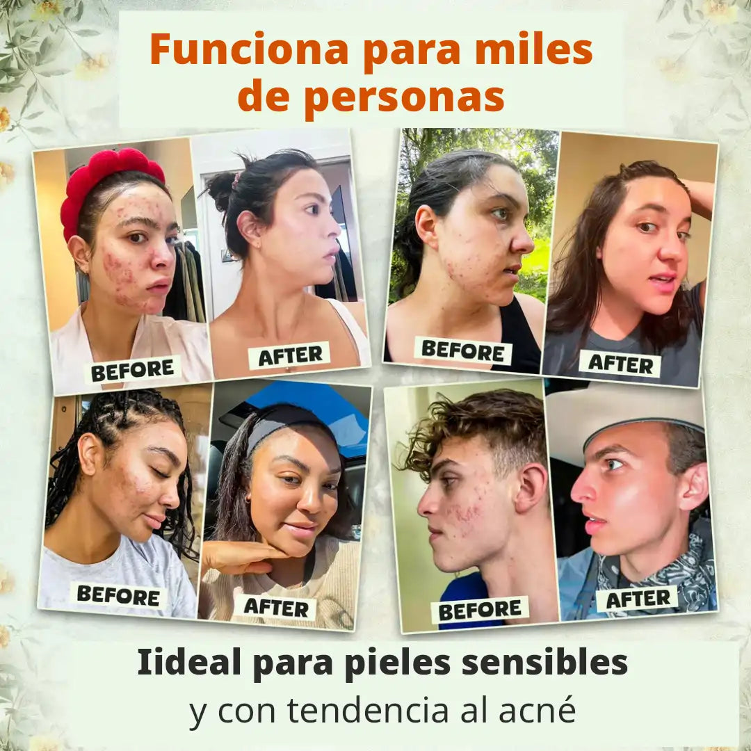 Evil Goods: Luce una piel más joven y saludable en solo 2 semanas, con una fórmula 100% natural (Tratamiento dura hasta 6 meses)