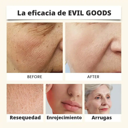 Evil Goods: Luce una piel más joven y saludable en solo 2 semanas, con una fórmula 100% natural (Tratamiento dura hasta 6 meses)