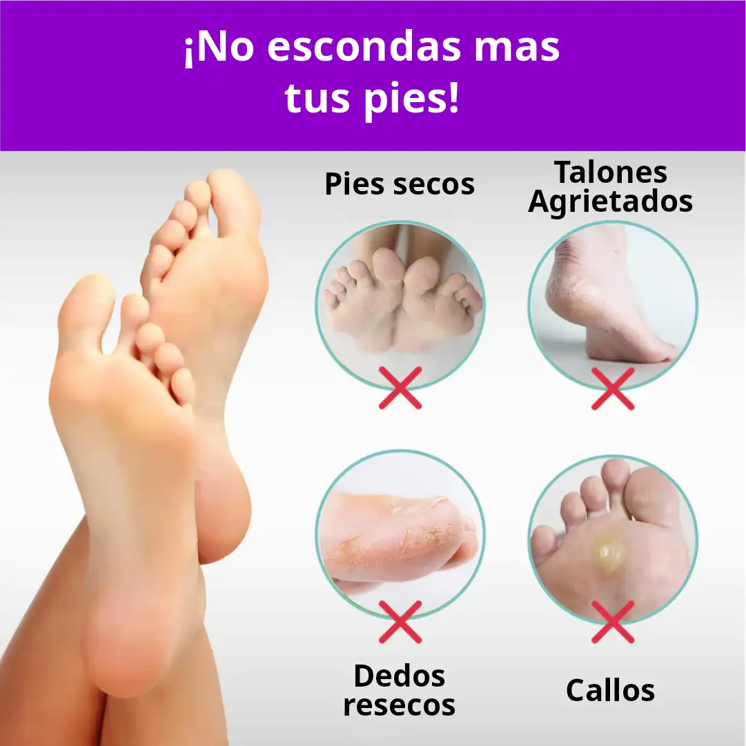 LuxaDerm 2x1: Luce tus pies suaves y renovados en cualquier ocasión en solo 10 dias